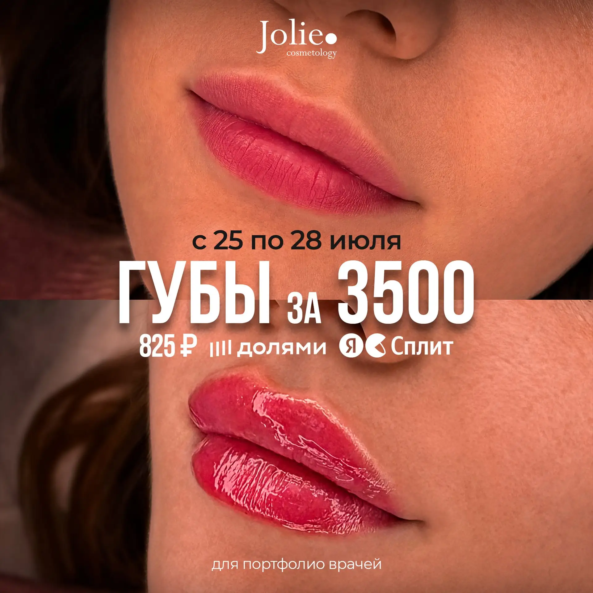 🔥 ГУБЫ ЗА 3500 ₽

с 25 по 28 июля (уточняйте дату)
📍 Кемерово | Омск

Хочешь красивые, увлажненные
