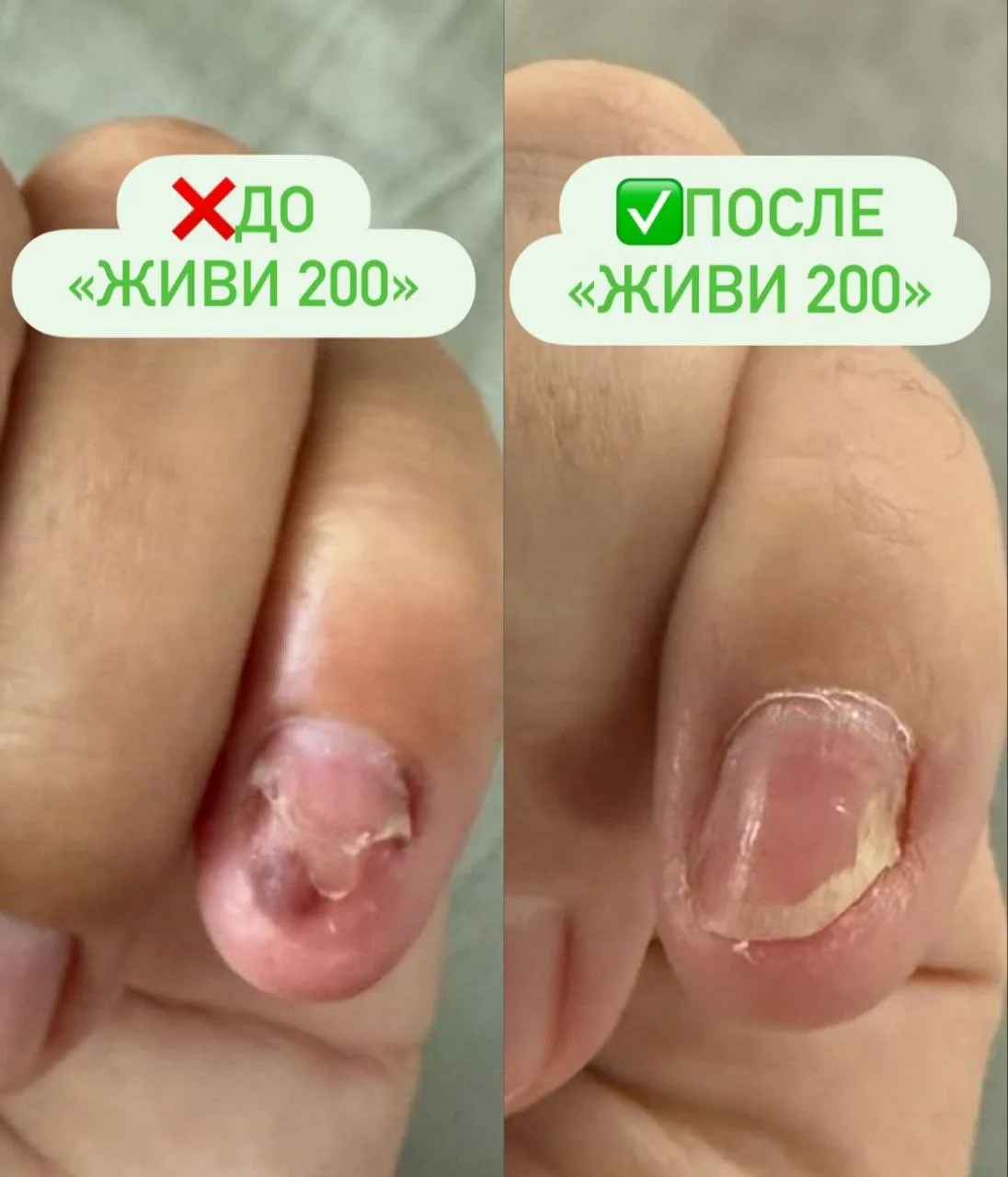 Что говорят о "Живи 200" покупатели 👆
