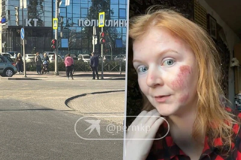 Пермячка разбила лицо о снятый асфальт. Предупреждающих знаков не было.