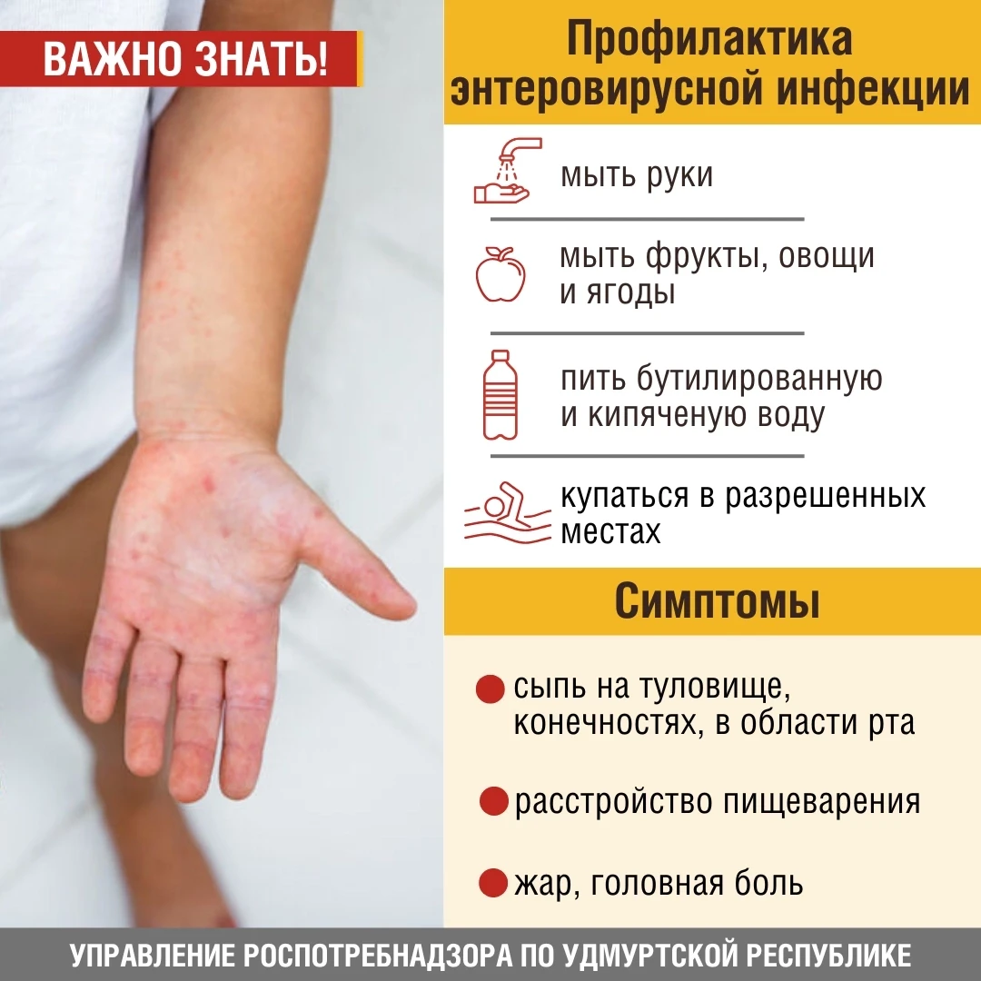 🤔Сыпь, жар, головная боль, расстройство пищеварения - возможно речь про энтеровирусную...