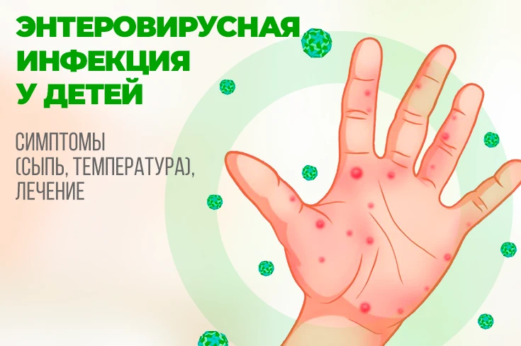 🦠 Энтеровирусная инфекция: что важно знать?
