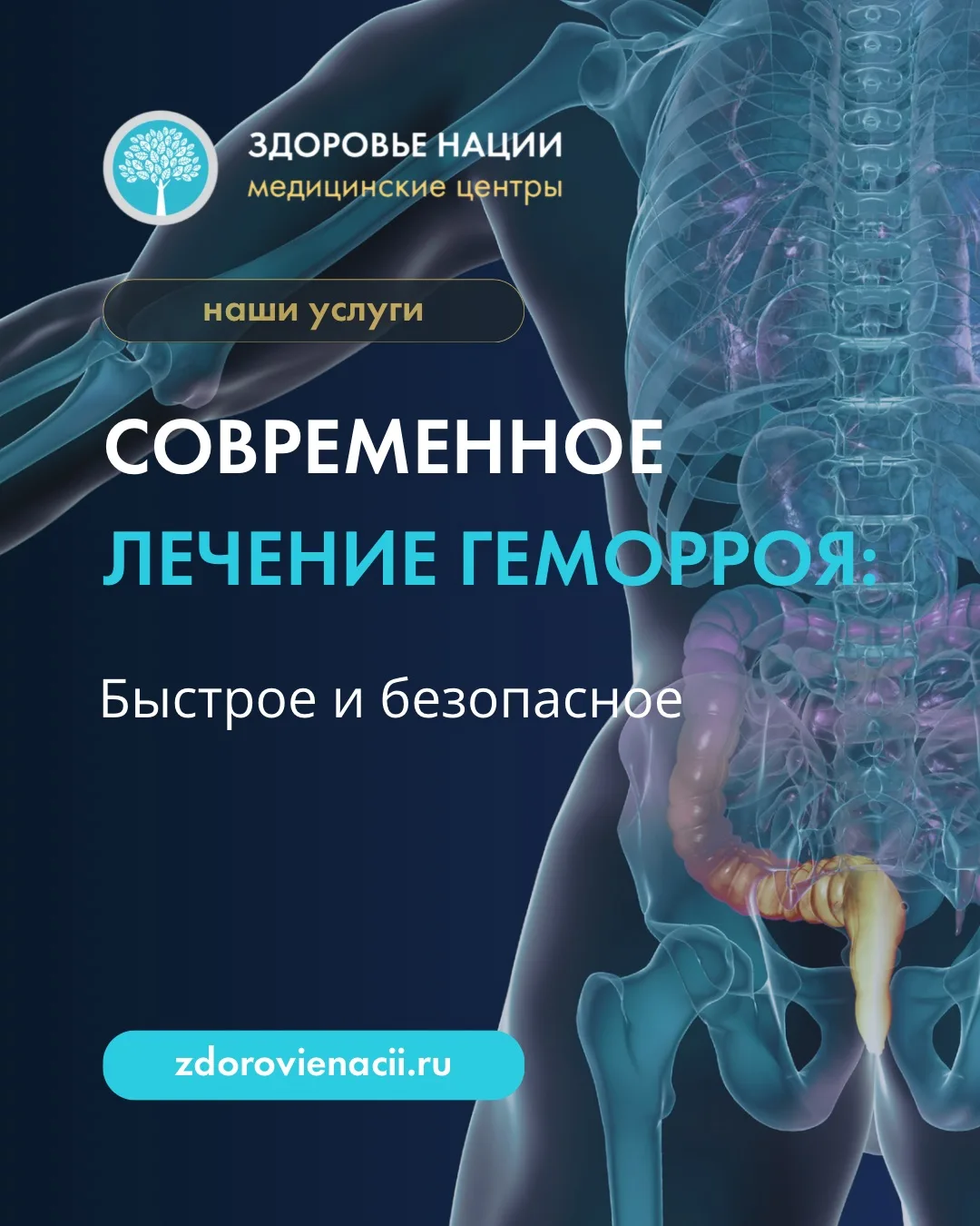 СОВРЕМЕННОЕ ЛЕЧЕНИЕ ГЕМОРРОЯ: