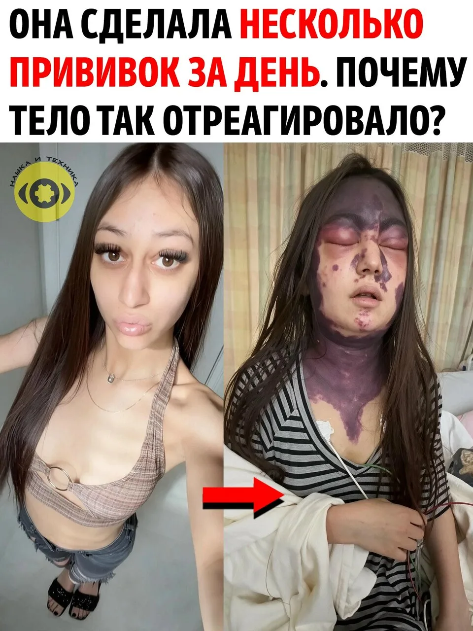 23-летняя Алексис Лоренц попала в больницу с редким заболеванием крови — пароксизмально...