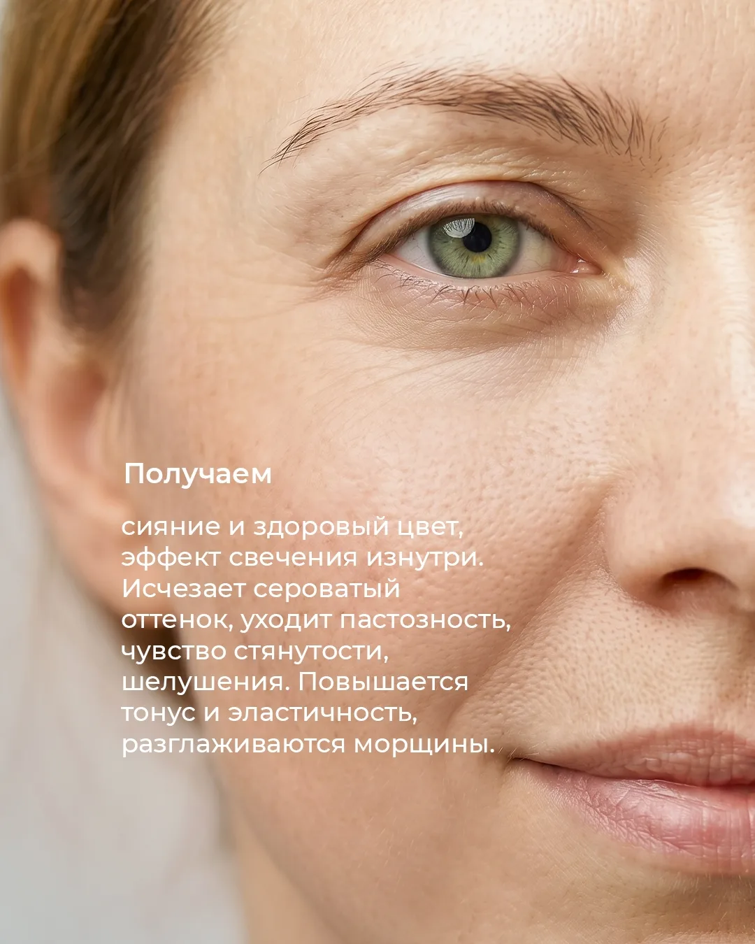 Пошаговая программа коррекции тусклой кожи с гиперкератозом и отёчно‑деформационными изменениями (в 