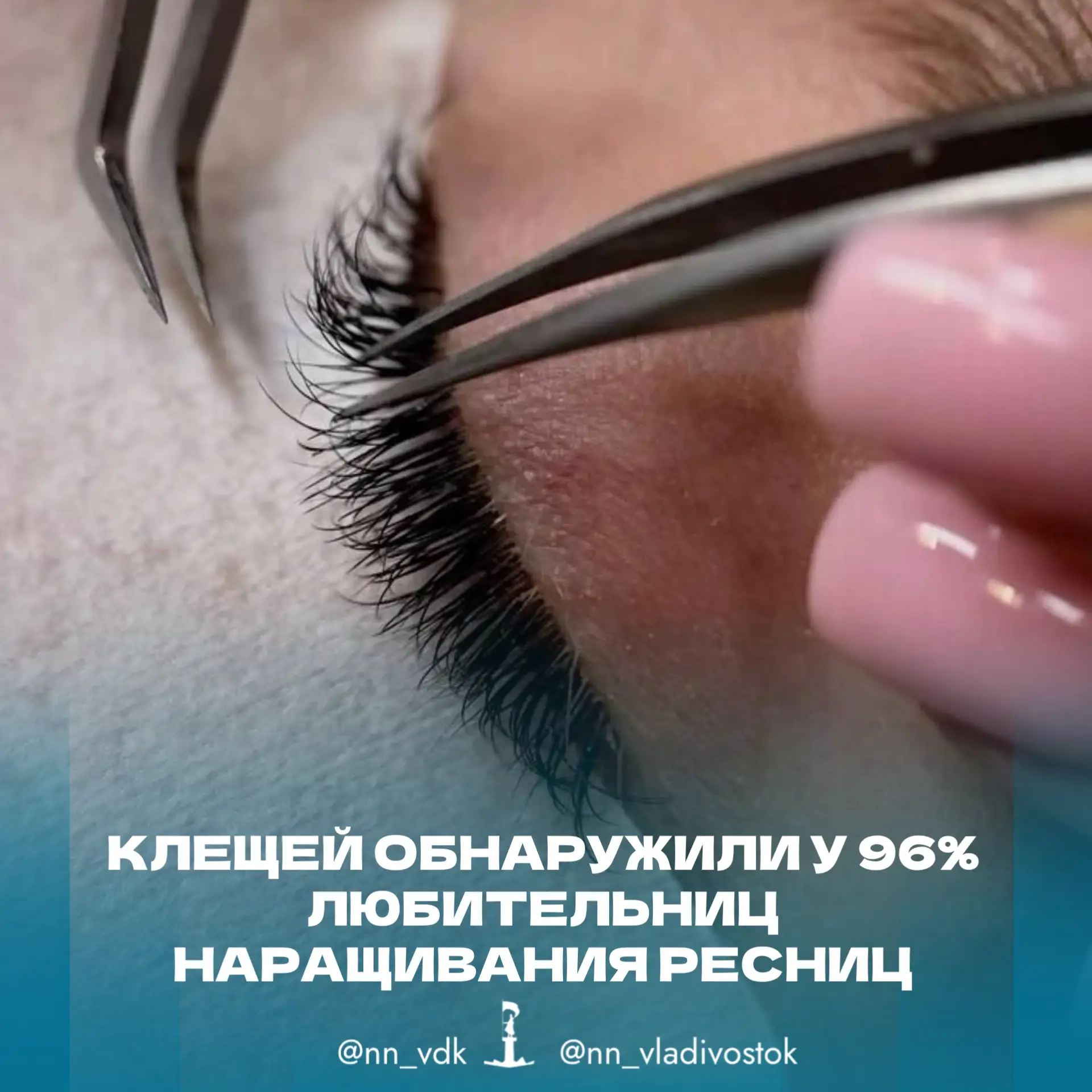 😱 Клещей обнаружили у 96% любительниц наращивания ресниц.