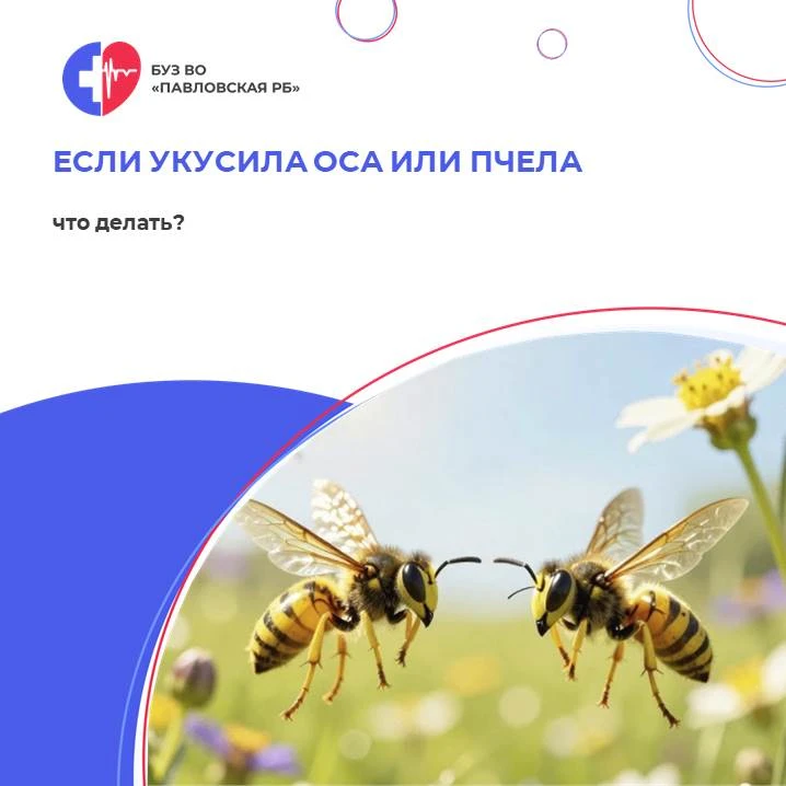 Что делать, если укусила оса или пчела?