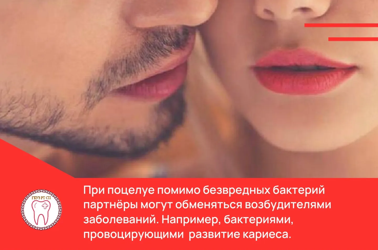 💕Можно ли заразиться кариесом при поцелуе?

Сам кариес не передаётся как заболевание — это не вирус