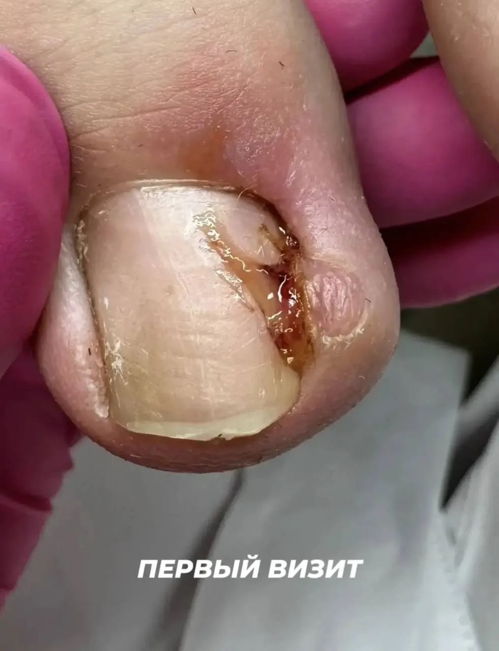 Иногда приходится использовать метод, который сам не очень любишь. Просто потому, что в...