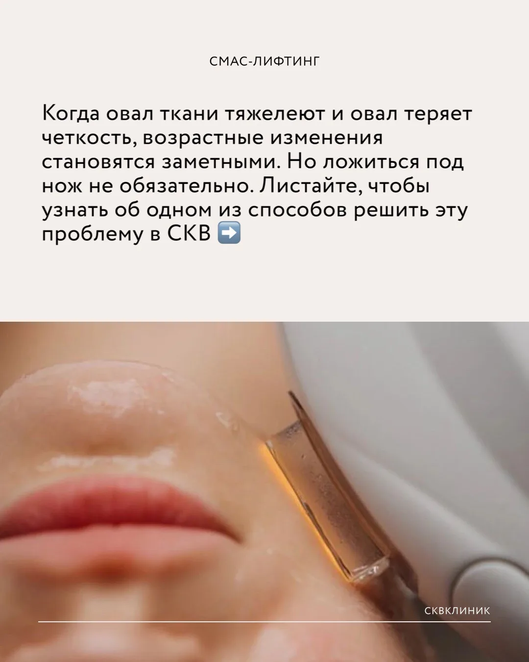 СМАС-ЛИФТИНГ В СКВ КЛИНИКЕ
⠀
Со временем овал теряет четкость, появляются брыли, кожа становится мен