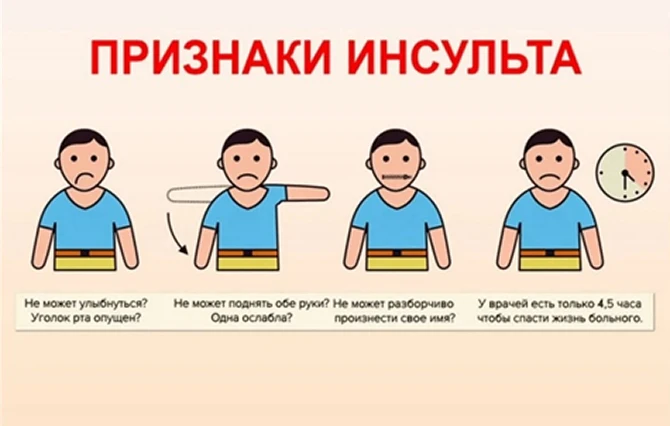 Факторы риска возникновения инсульта.