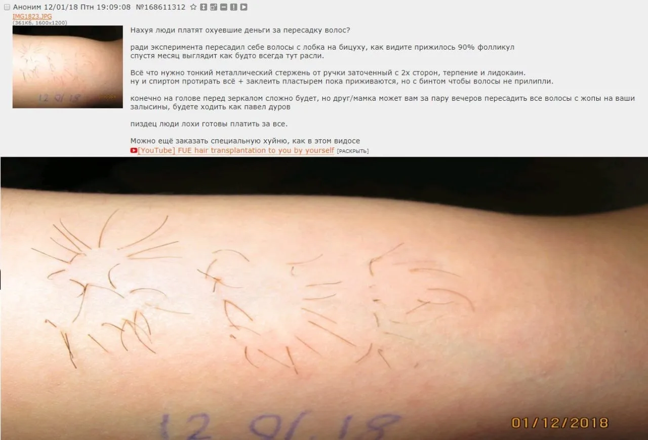 Теперь, как я понимаю, клиники в Турции перестанут работать?
