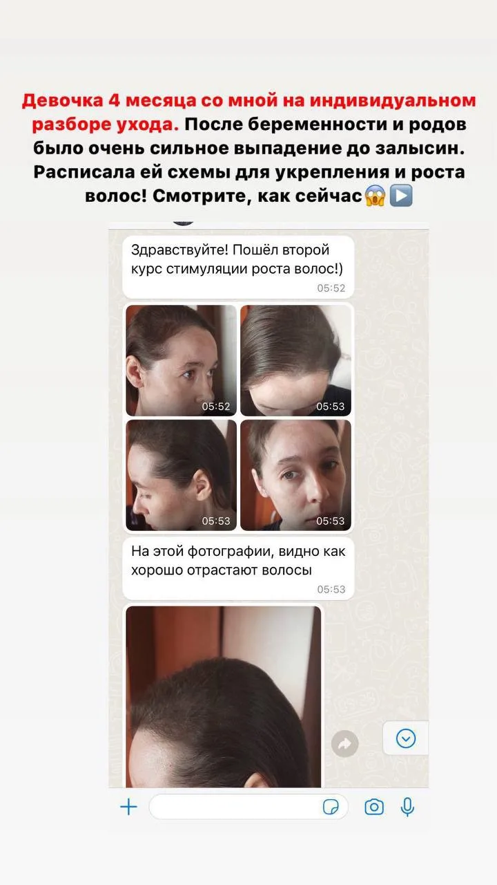 Ты тоже устала собирать с расчёски клочки волос? Постоянно стричь кончики из-за сечения...