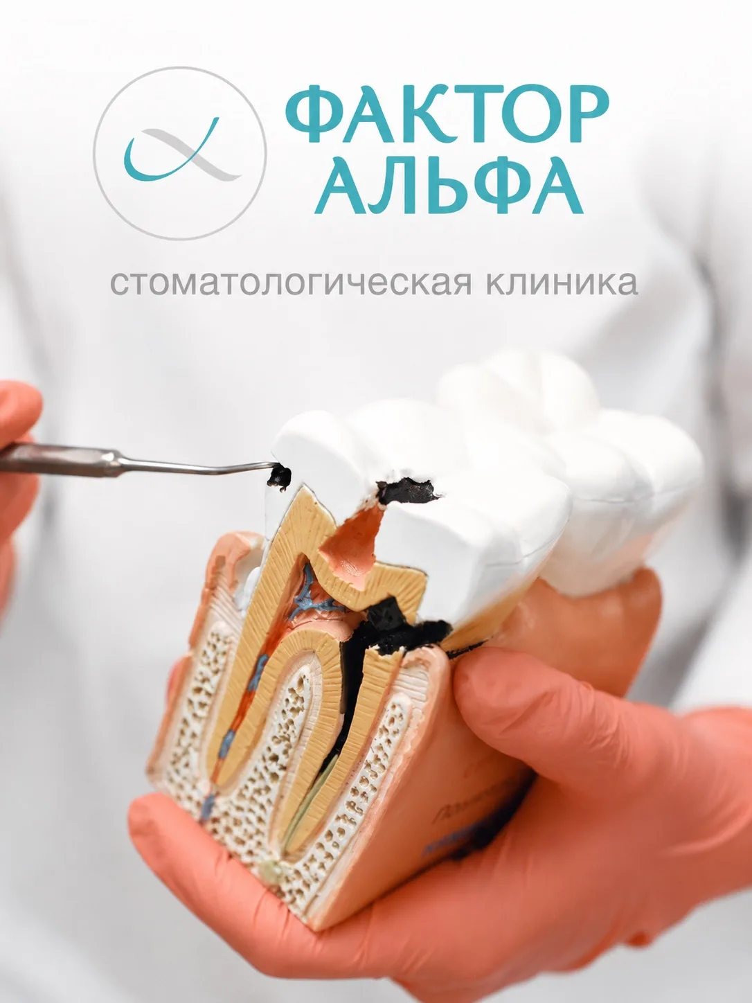 🦷 Правда ли, что кариесом можно «заразиться»?

Да, бактерии, которые вызывают кариес, могут передав
