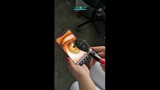 Как выглядит онлайн консультация по мнению пациента 😂👁️🔬