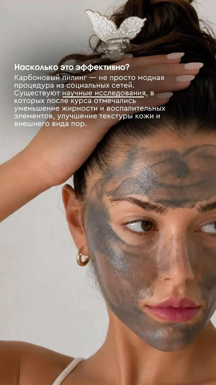 КАРБОНОВЫЙ ПИЛИНГ. Новая услуга в LAWRE