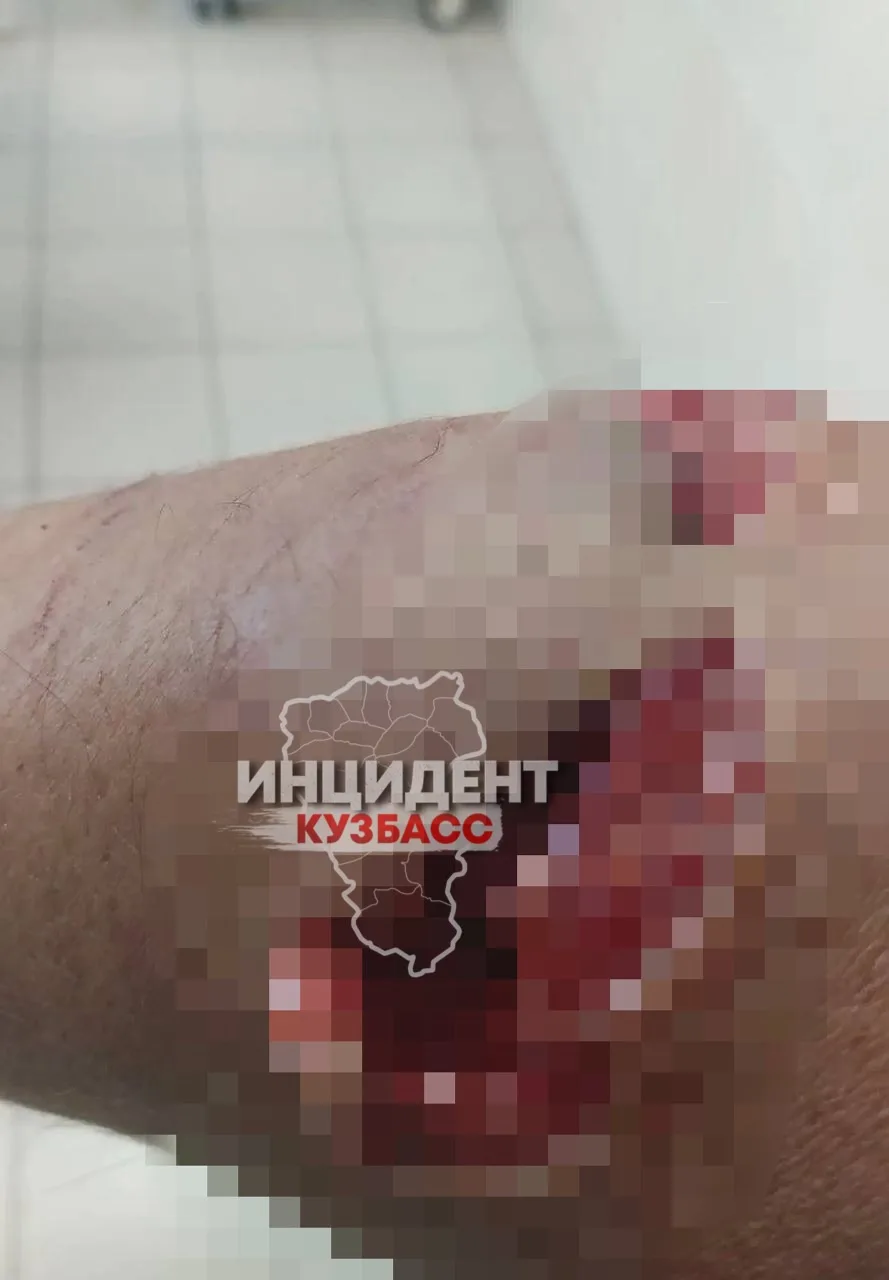 Появились фотографии пострадавшего мужчины, который влетел в витрину в новокузнецком ТЦ