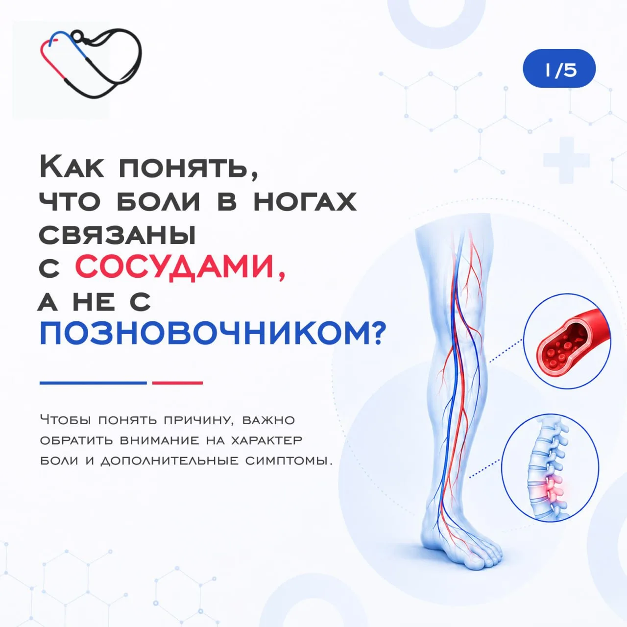 Как понять, что боль в ногах связана с сосудами, а не с позвоночником?