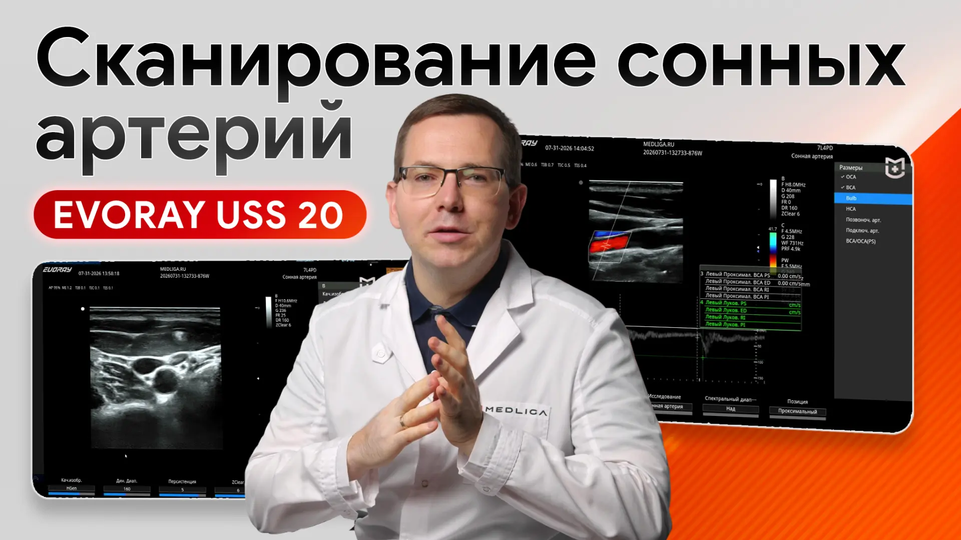 ⚡️EVORAY USS 20 в УЗИ сосудов шеи: возможности аппарата на сонных артериях