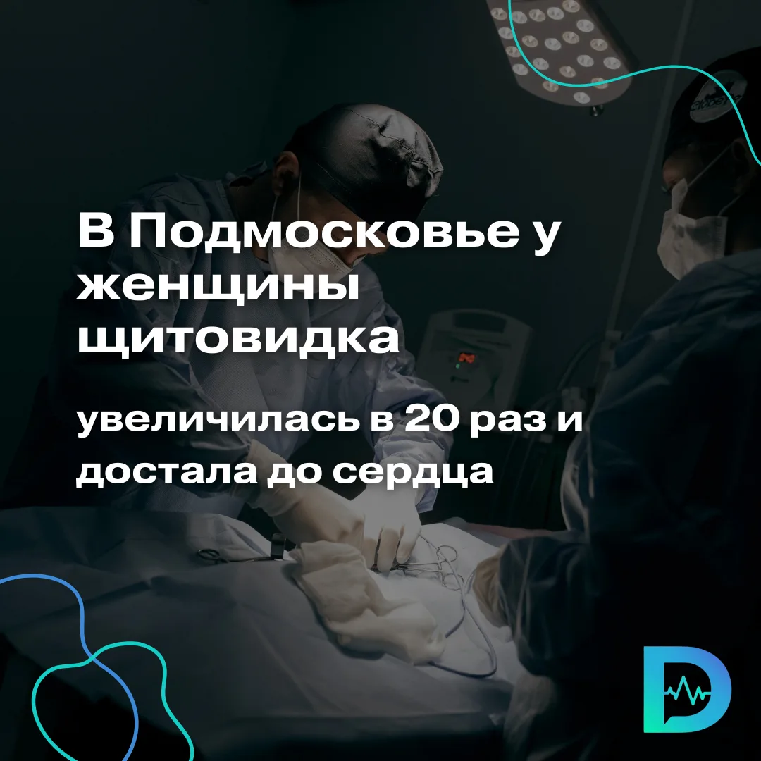 В Московской области врачи столкнулись с крайне запущенным случаем многоузлового зоба. У пациентки щ