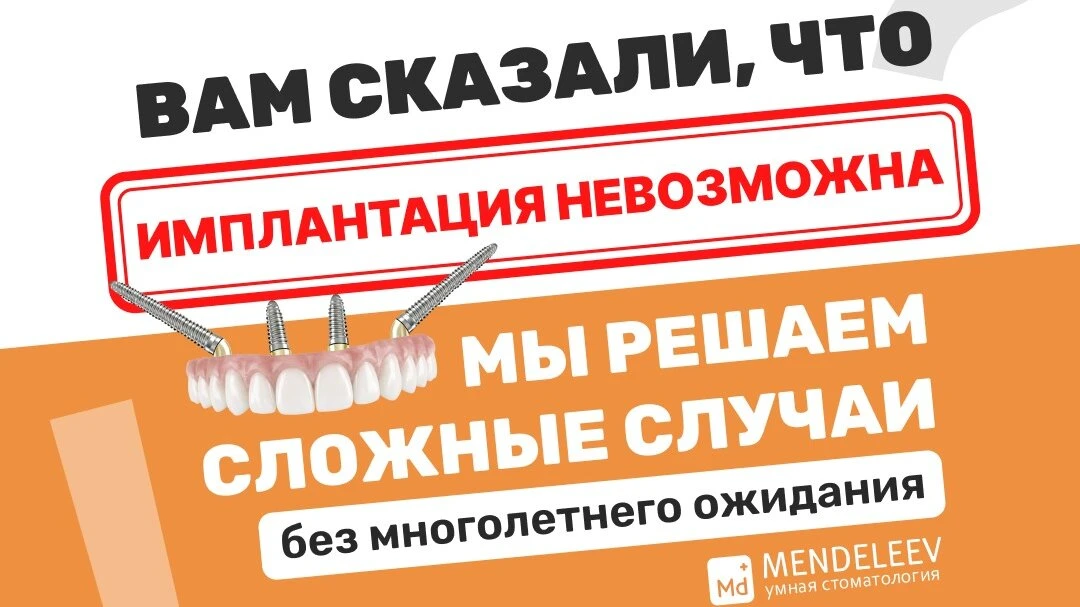 Центр имплантации всех зубов челюсти: Москва «Менделеев»