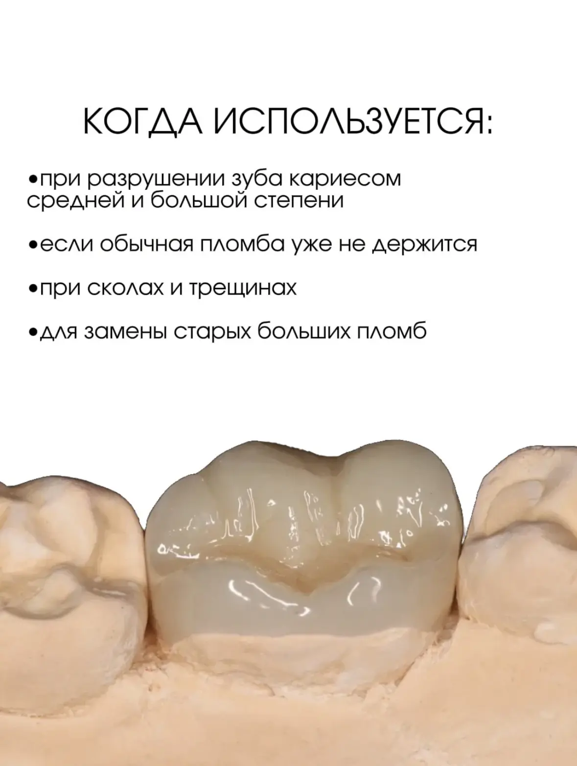 КЕРАМИЧЕСКАЯ НАКЛАДКА