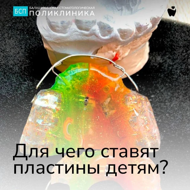 🦷 Для чего ставят пластинки детям?