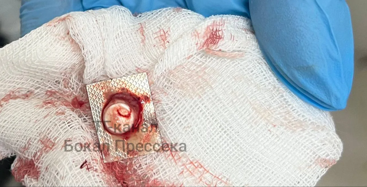 💊 В Нижнем Новгороде мужчина случайно проглотил таблетку в блистере  Нижегородец так торопился, что 