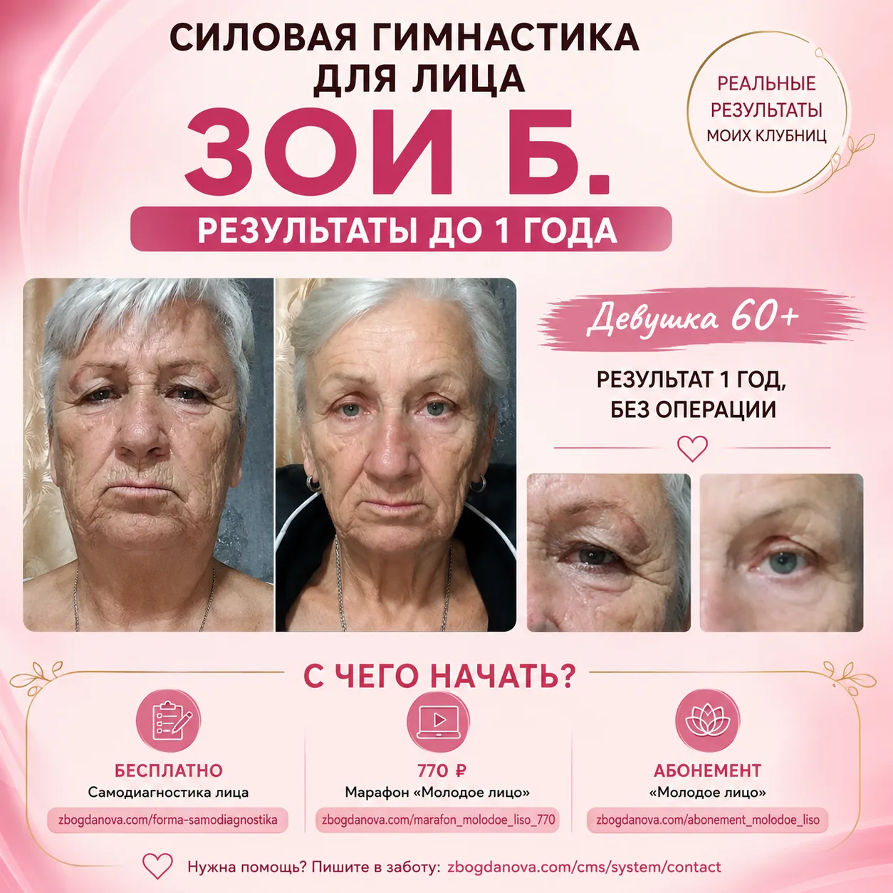 БЛЕФАРОПЛАСТИКА ИЛИ ГИМНАСТИКА? А МОЖЕТ, СНАЧАЛА ПОПРОБОВАТЬ ТО, ЧТО МОЖНО ОТМЕНИТЬ?
