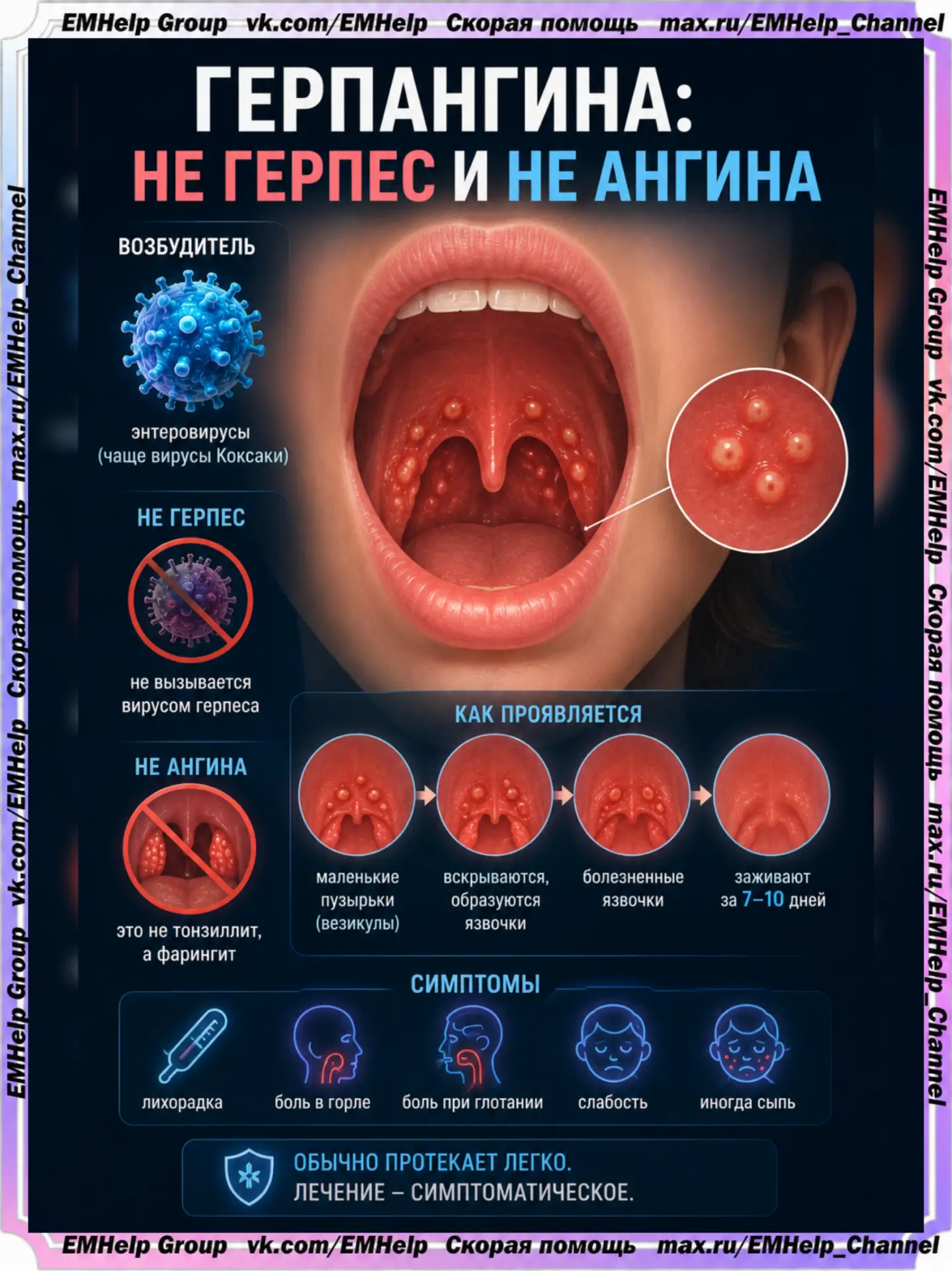 🦠 Герпангина: не герпес и не ангина
Название обманчиво. Слово «герпангина» звучит как комбинация ге