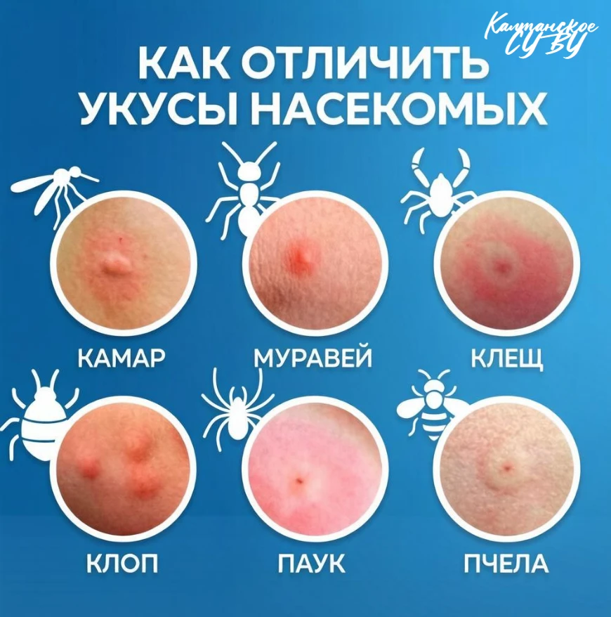 Лето, природа и... насекомые: как пережить сезон без последствий 🦟🌲