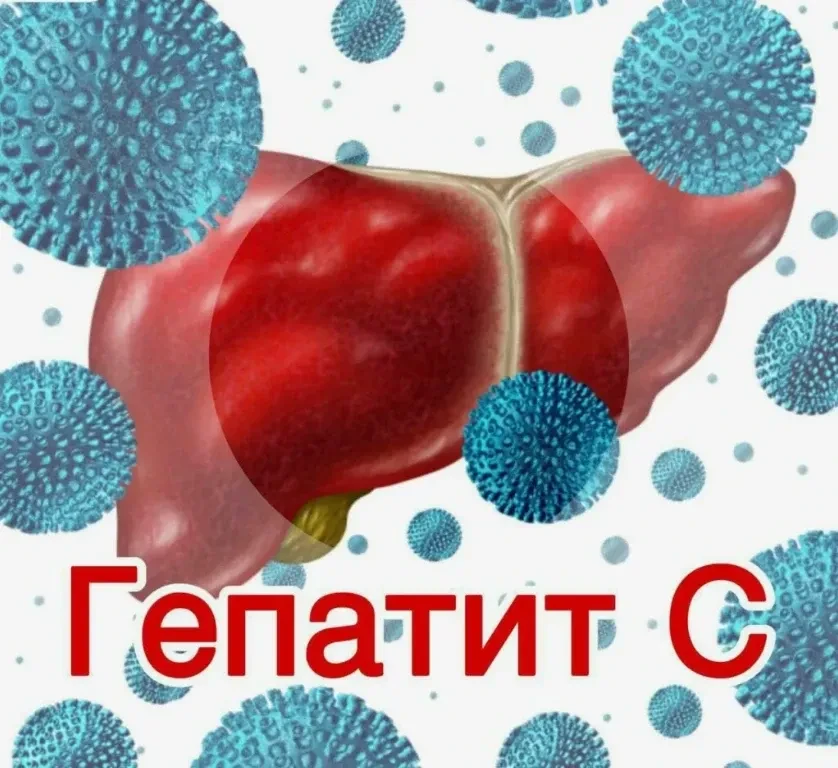 ❗Что представляет собой гепатит С и каковы пути его передачи

🦠 Гепатит С – это заболевание печени,