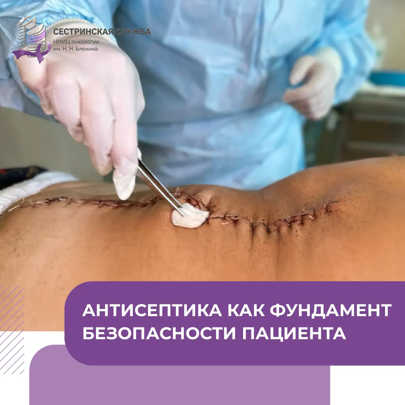 В прошлый раз мы подробно разобрали принципы асептики. Ведь это наш «щит», не позволяющ...