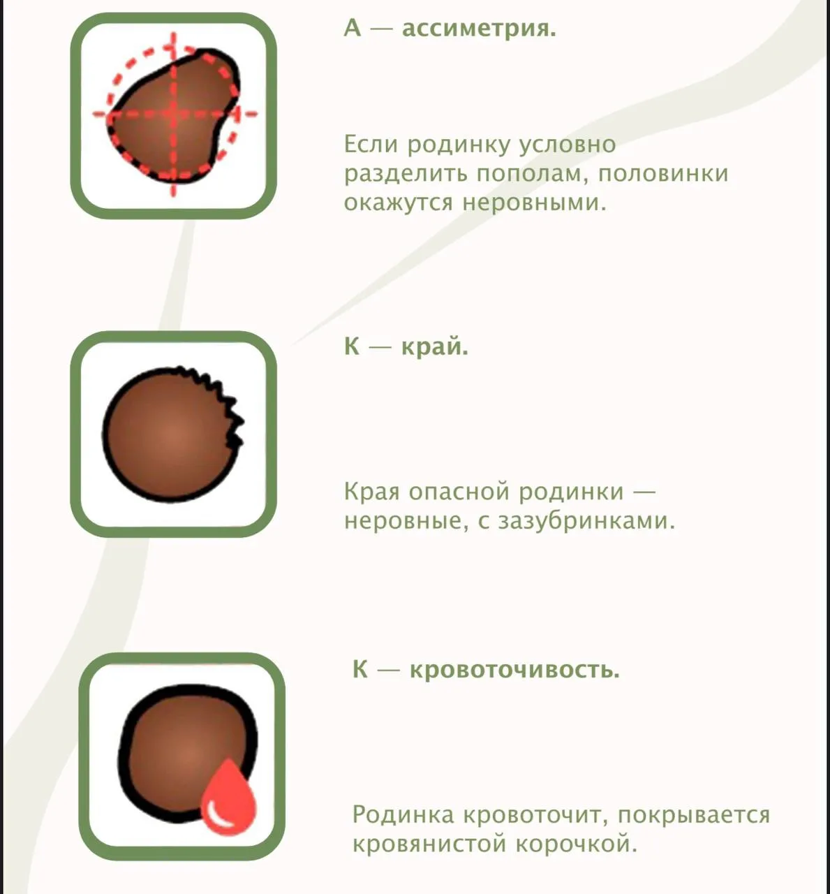 БОЛЬШАЯ ПРОБЛЕМА?

наличие больших родинок на теле - это всегда показание к операции (к удалению)?

