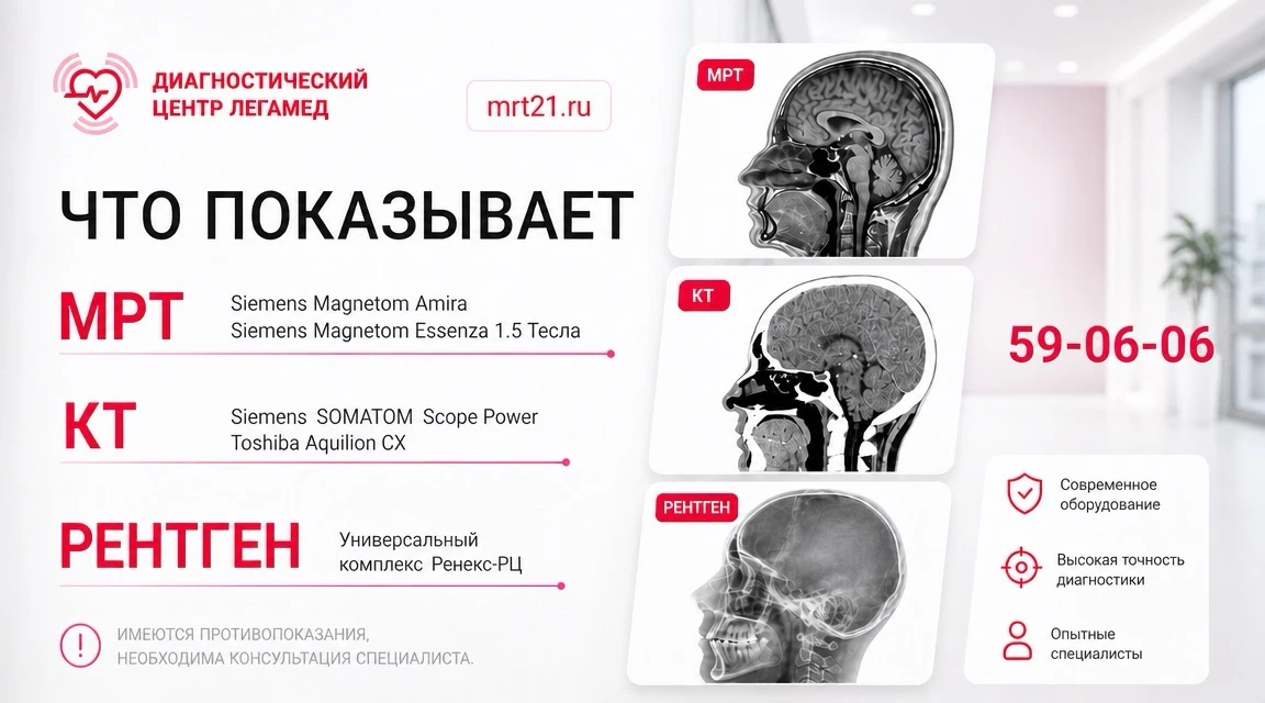 Что показывает МРТ/КТ/РЕНТГЕН лучше всего? 

✅Магнитно - резонансная томография (МРТ)
- Головной моз