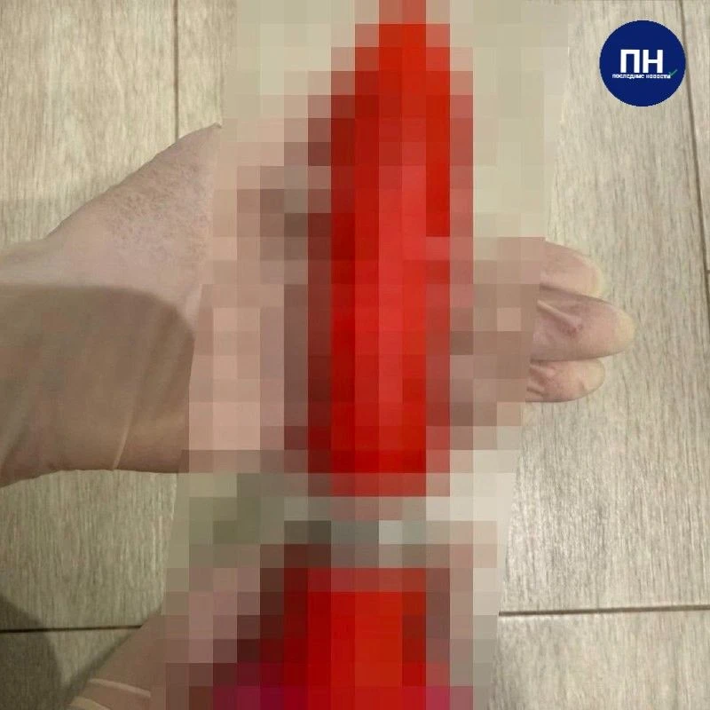 🥴Уфимец засунул себе в зад*ицу огромный дил*о по совету «ChatGPT».