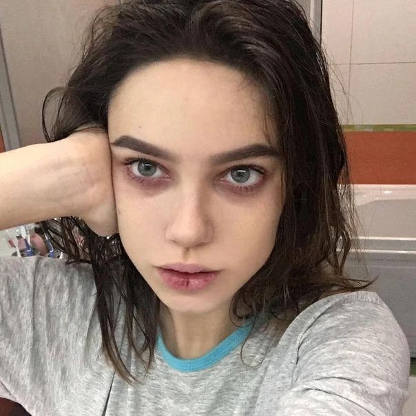 Как скрыть мешки под глазами👇

💘Холод — твой лучший помощник. Используй охлаждённые патчи или ложк