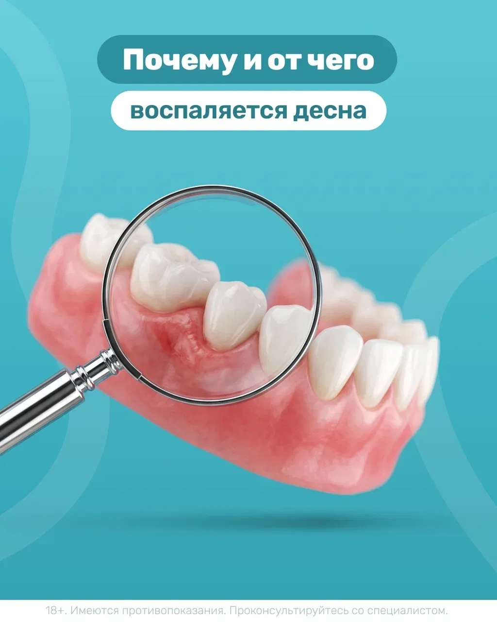 ⚡️ Почему и от чего воспаляется десна?