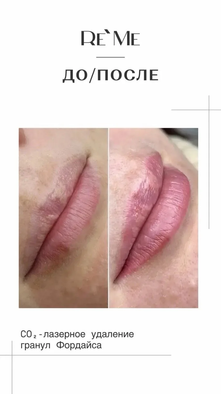 Нежное преображение губ 😍