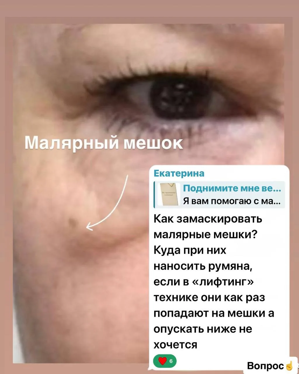 Маскируем малярные мешки с помощью макияжа