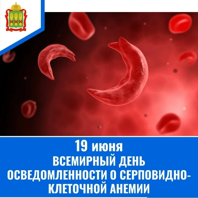 Всемирный день осведомленности о серповидно-клеточной анемии отмечается ежегодно.

Симптомами заболе