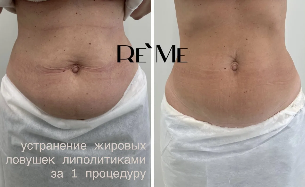 Клиника косметологии и пластической хирургии Re’Me