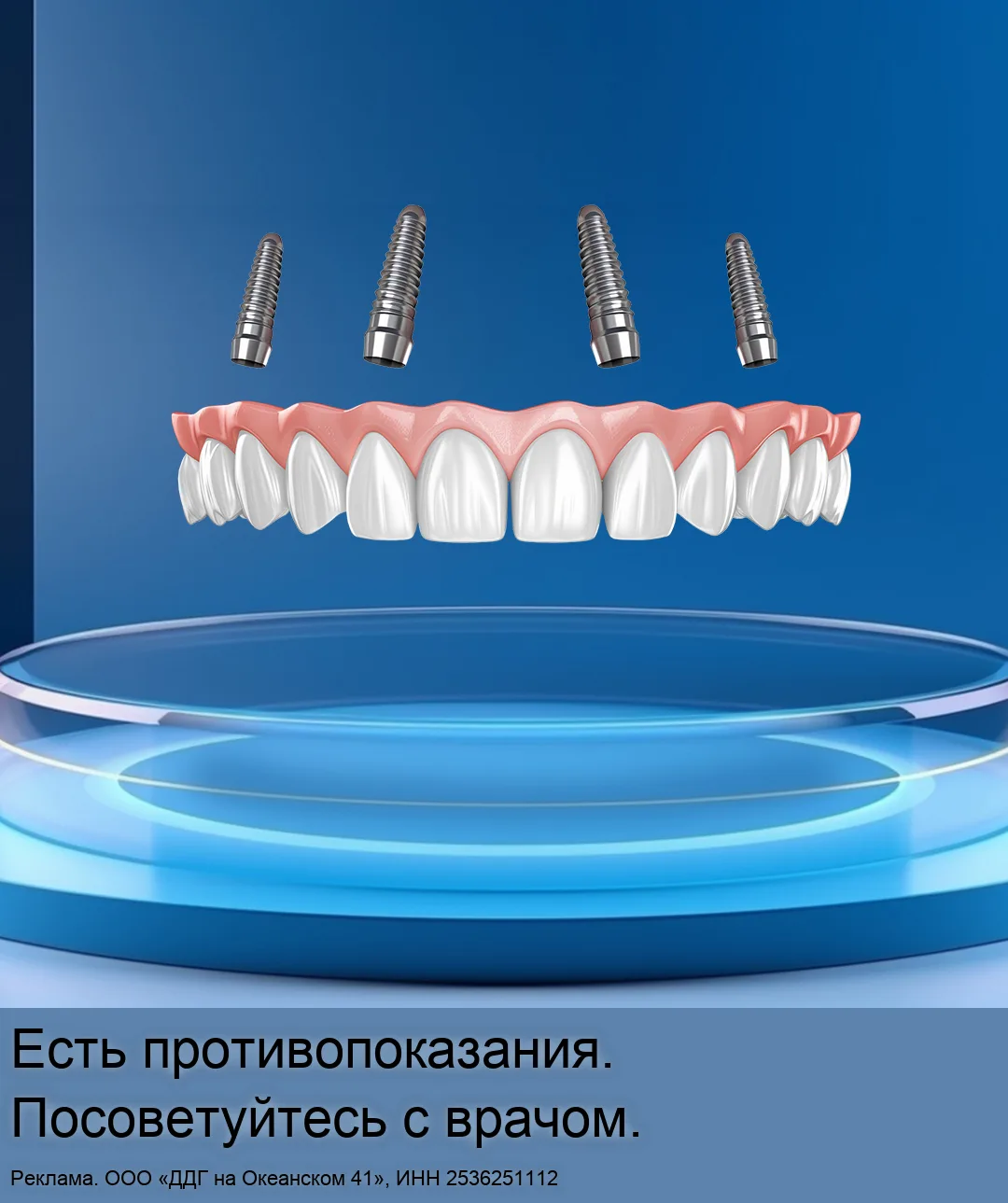 Новые зубы сразу от 119 000 ₽. Рассрочка до 24 месяцев!