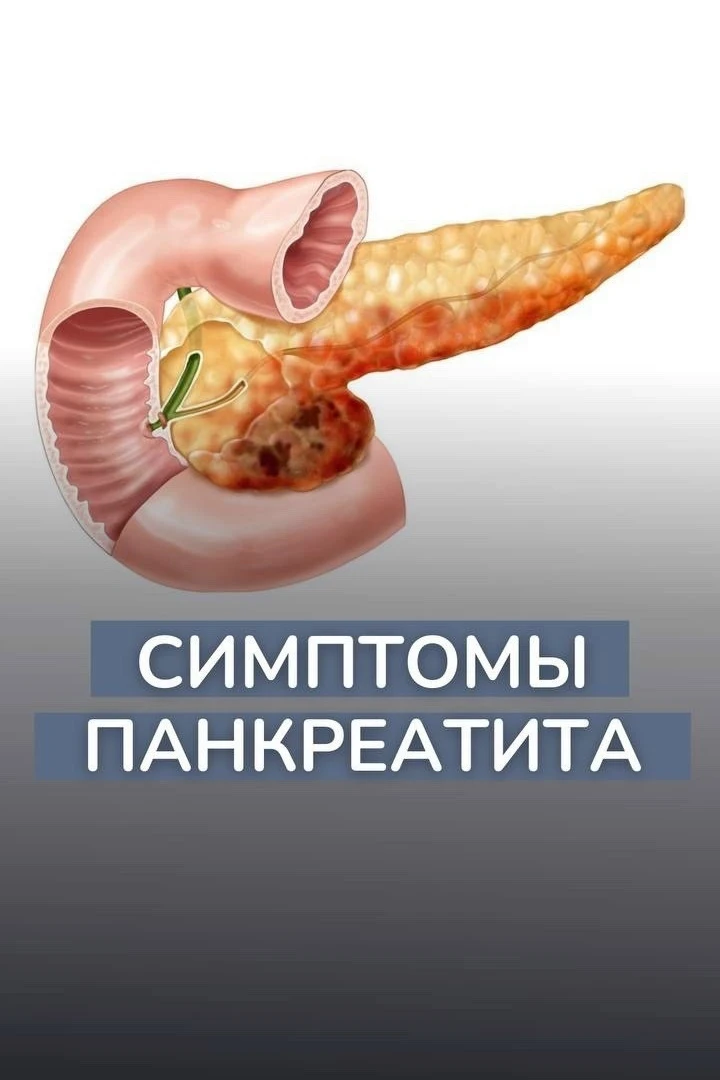 Панкреатит: симптомы и важность обращения к врачу