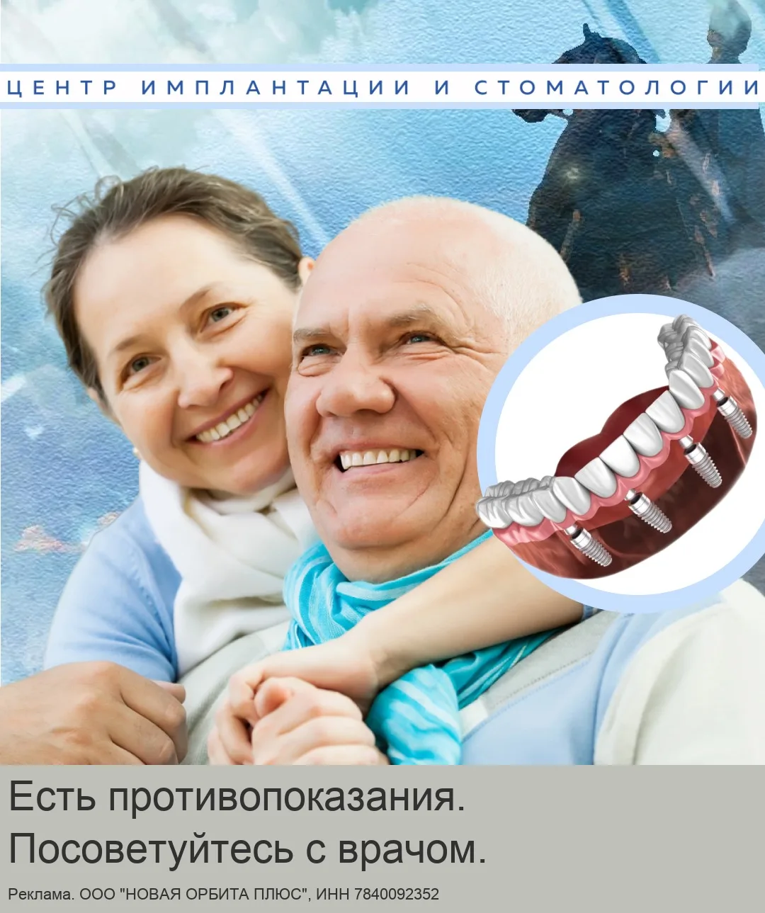 Все зубы на 4-х имплантах в СПб. Пенсионерам льготы!