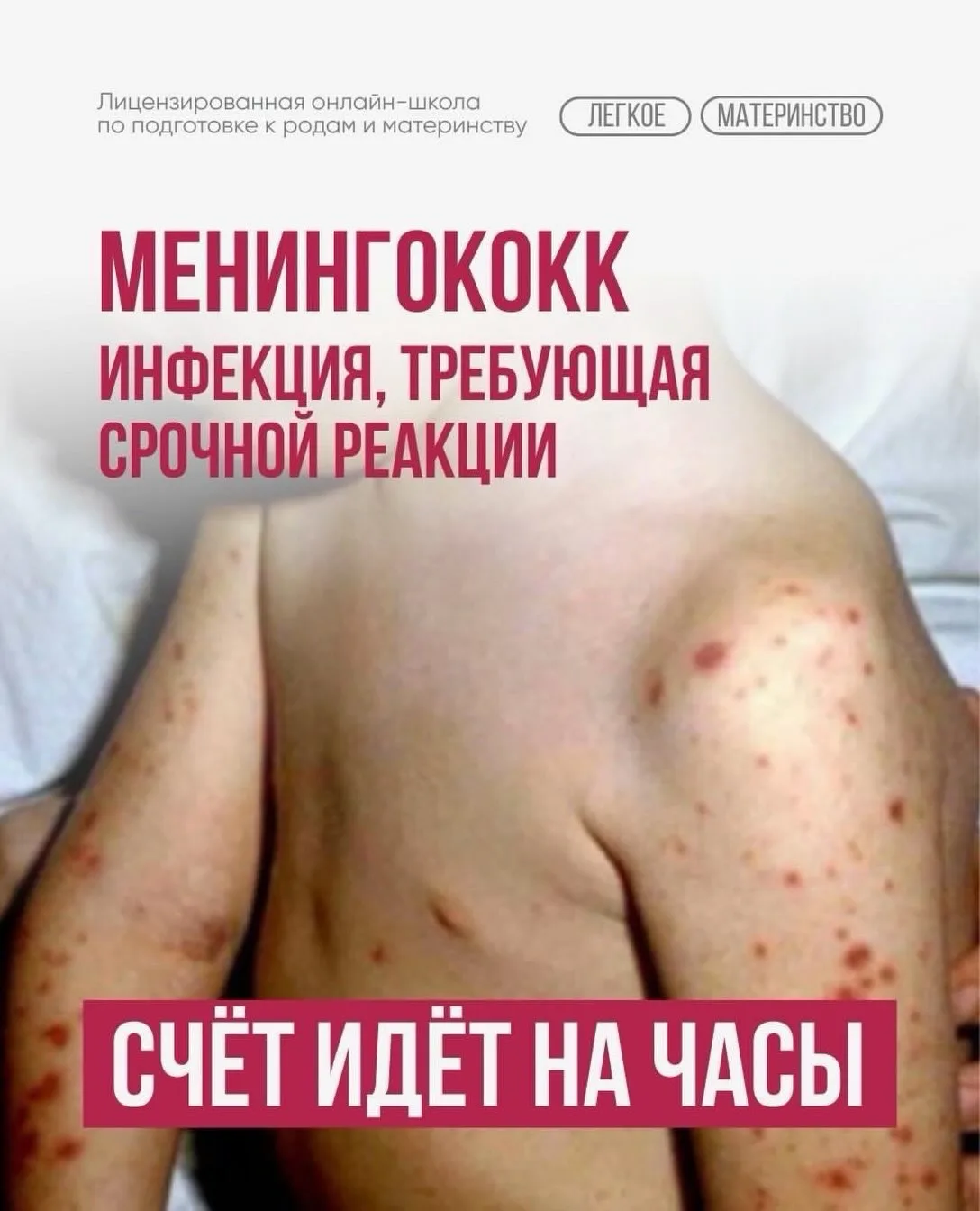 ​​Менингококковая инфекция