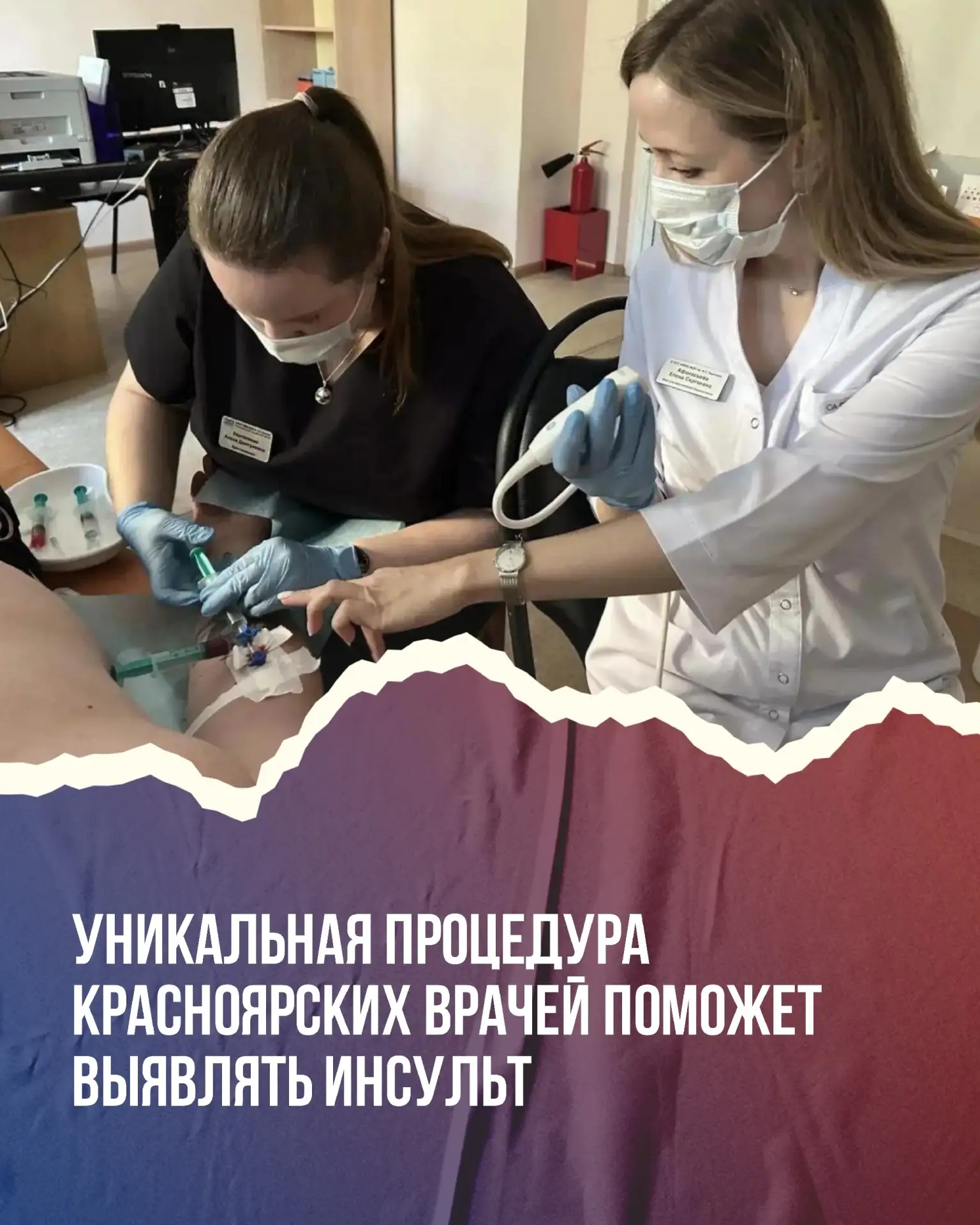 🩺 Красноярские врачи нашли уникальный способ выявления инсульта у молодых