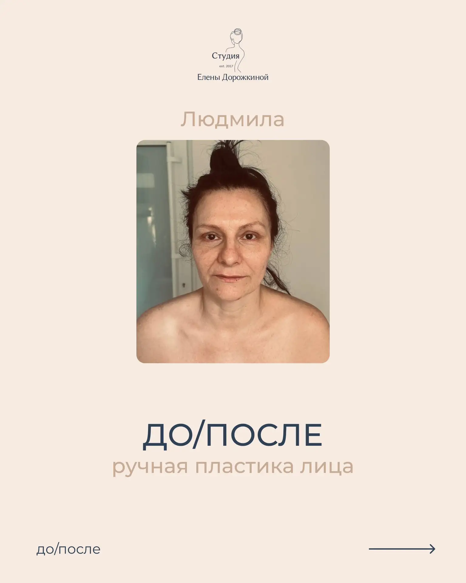 А надолго ли эффект? (самый частый вопрос)