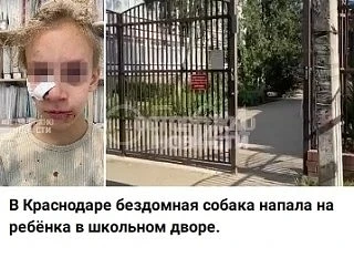 В Краснодаре бездомная собака напала на 8-летнюю девочку