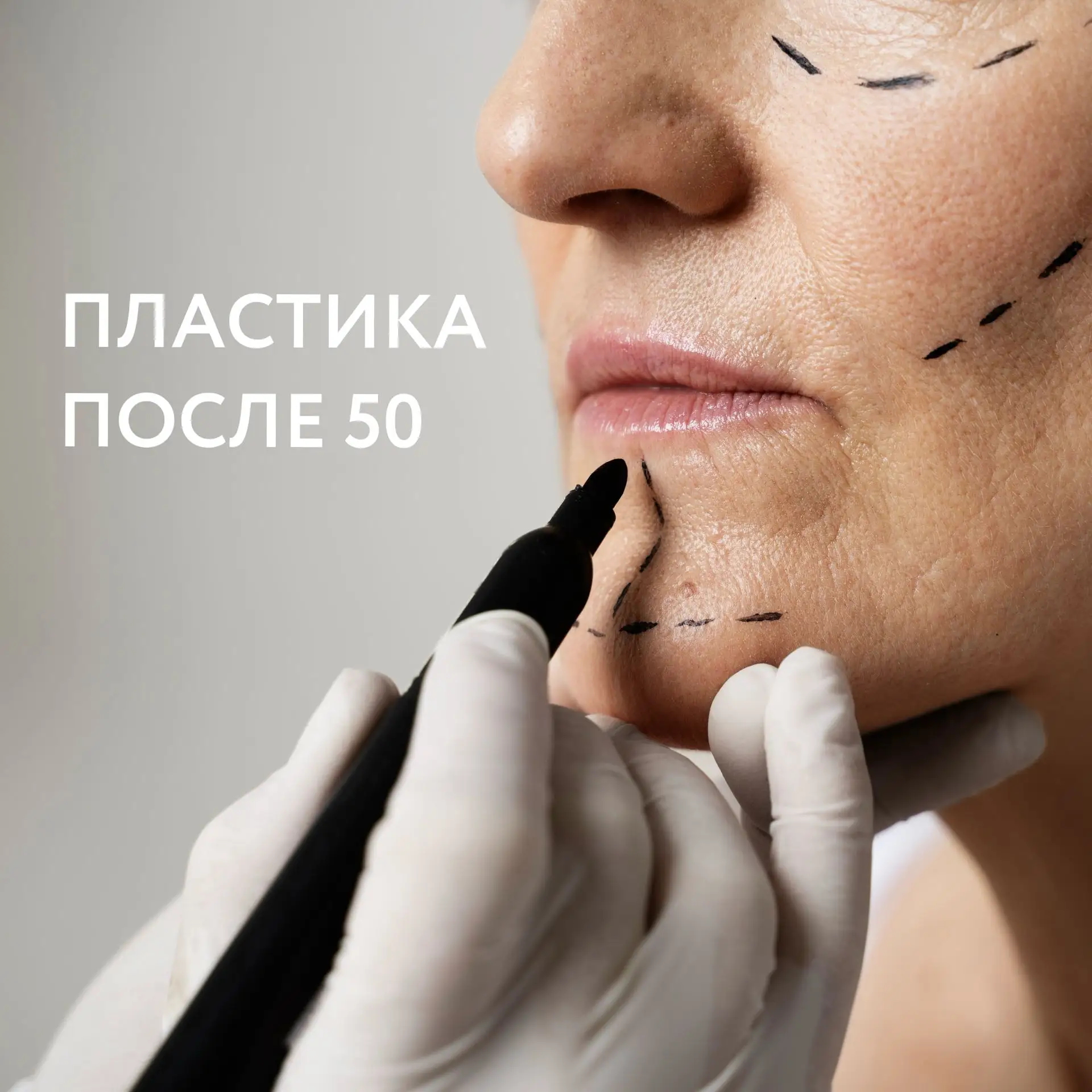 Поздно ли делать пластическую операцию после 50 лет? 

☝🏻 Нет. Возраст сам по себе не является прот