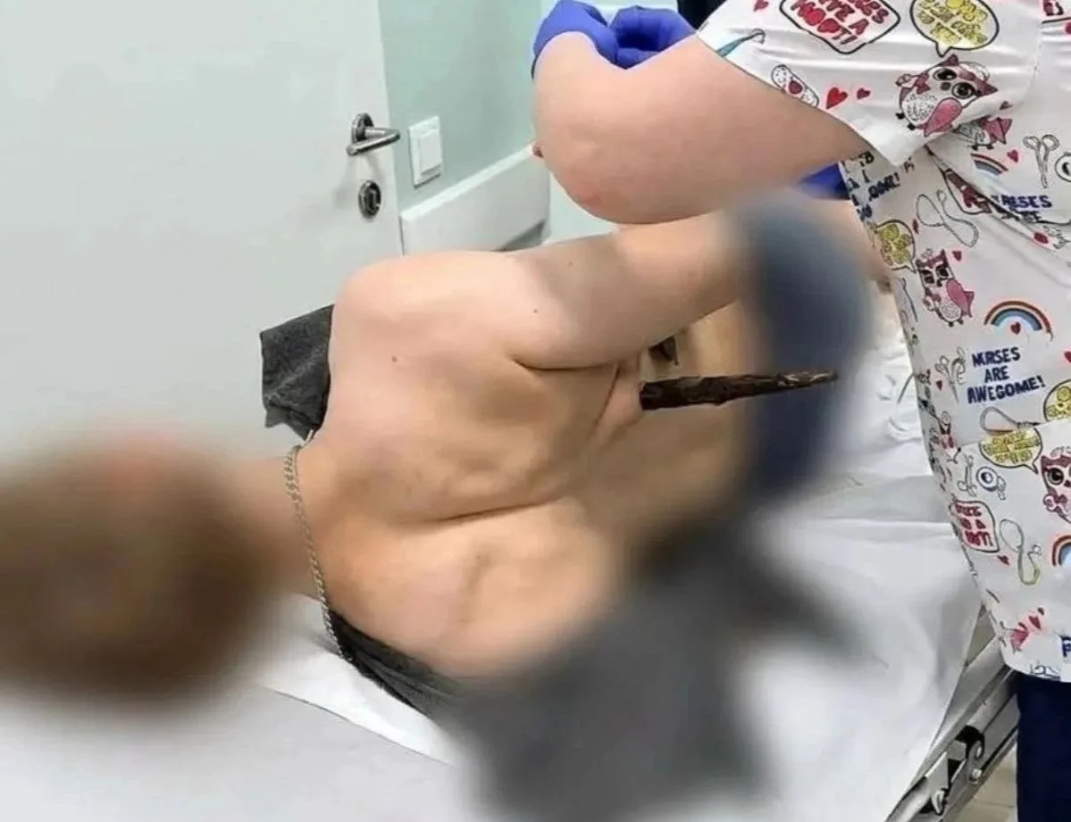 Врачи областной больницы №3 в Череповце спасли 18-летнего парня после тяжёлой аварии на...